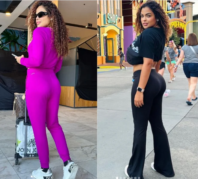 Paula Freitas do BBB 23 após cirurgias Reprodução