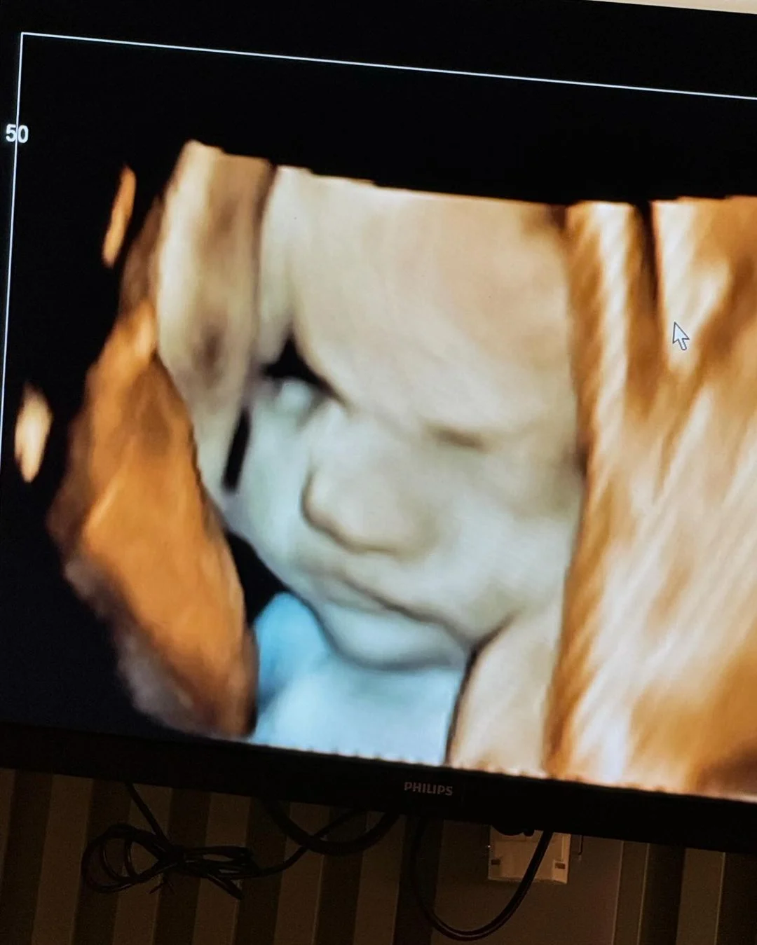 Ultrassom de Zé Leonardo Reprodução
