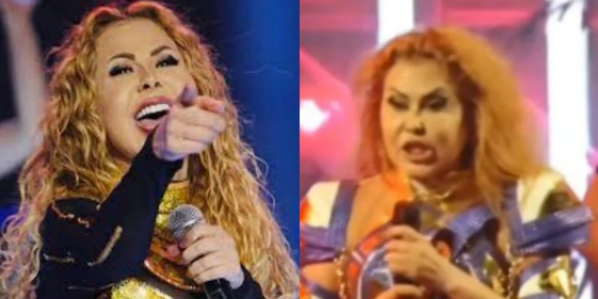 Joelma deixou os seus fãs preocupados com inchaço no rosto Reprodução