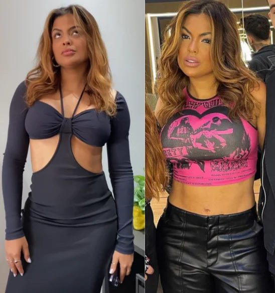 Paula Freitas do BBB 23 após cirurgias Reprodução