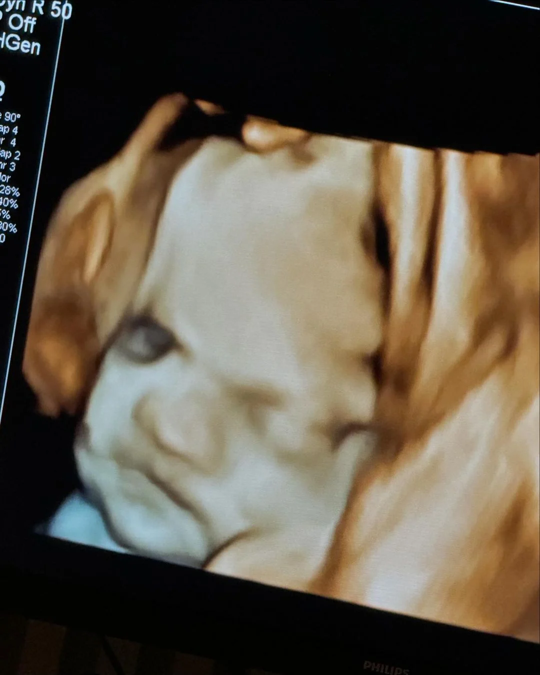 Ultrassom de Zé Leonardo Reprodução