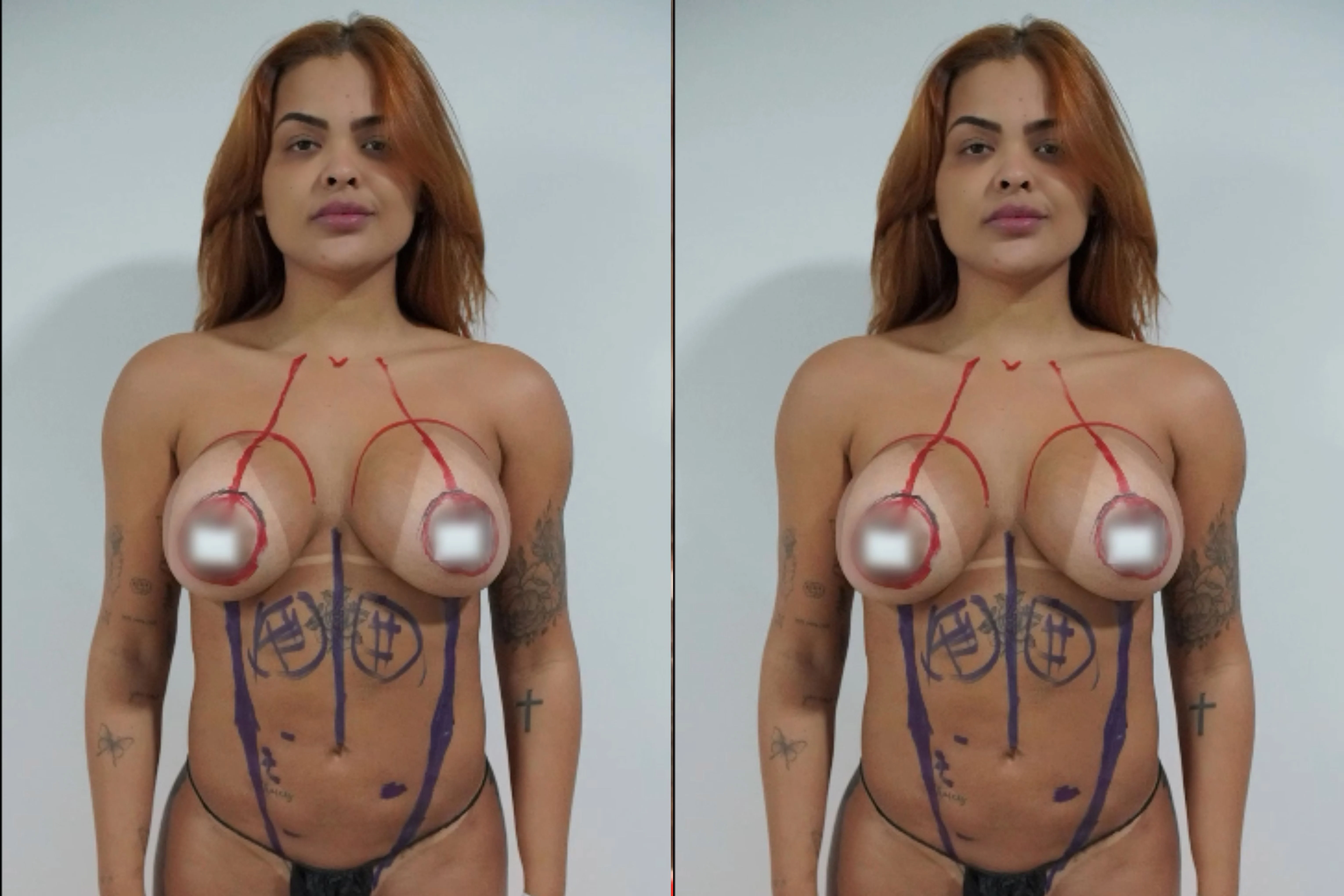 Paula Freitas, do BBB23, mostra resultados da cirurgia de redução de cintura Instagram