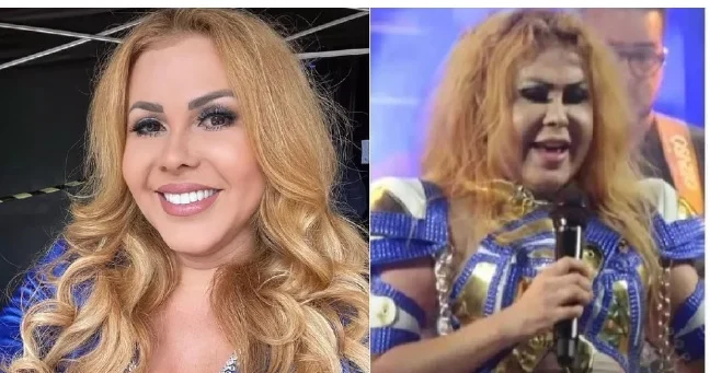 Cantora revelou motivo de inchaço Reprodução