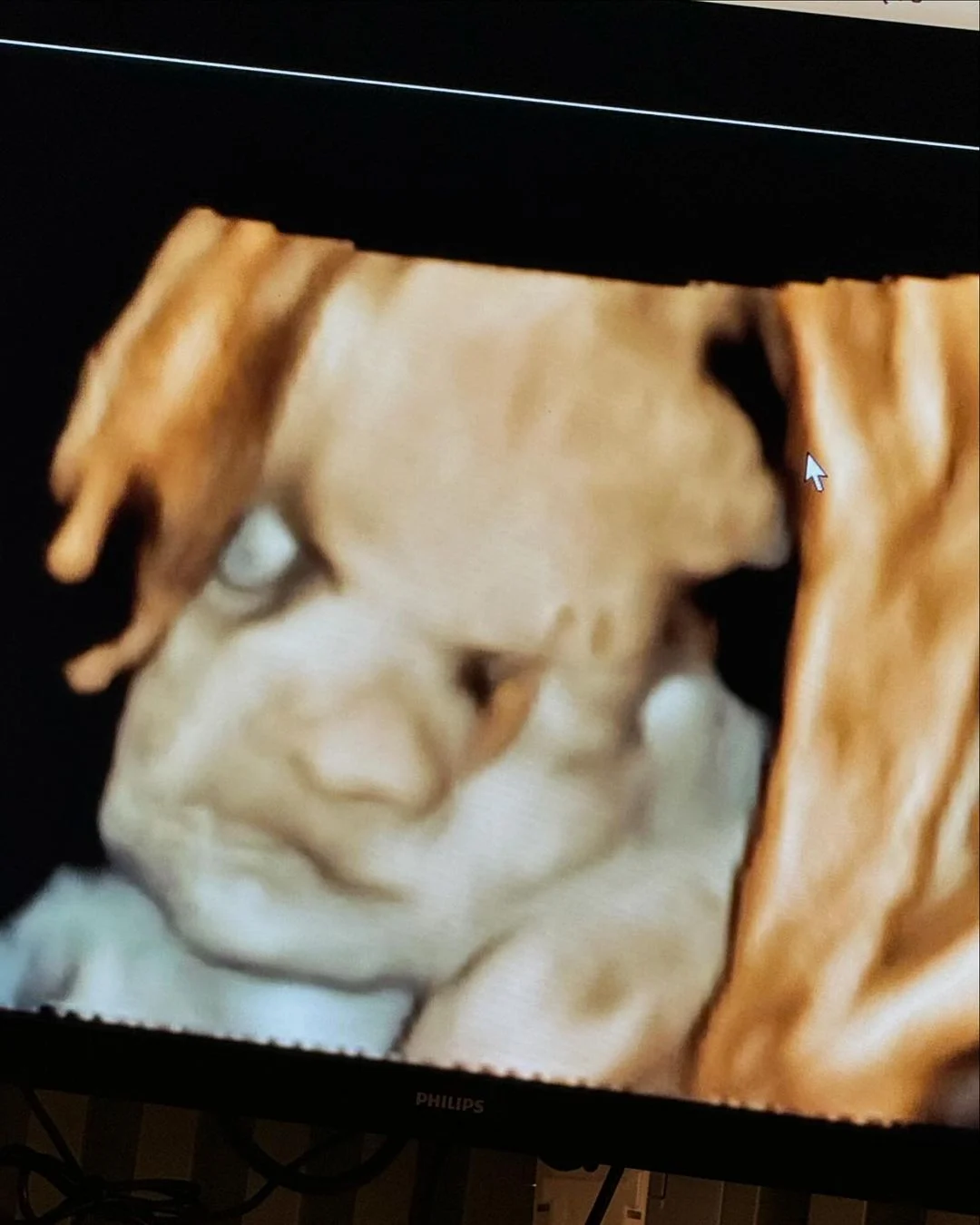 Ultrassom de Zé Leonardo Reprodução