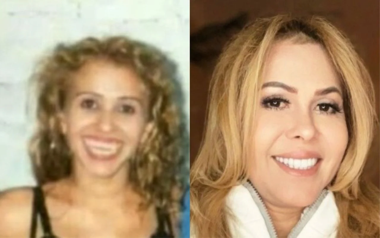 Joelma - Antes e Depois  Reprodução: Flipar