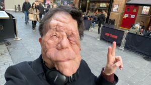 Adam Pearson critica papéis estereotipados a atores com deficiência