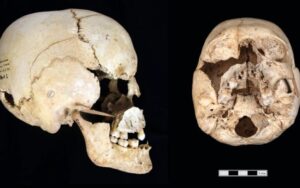 Primeira pessoa pré-histórica sem um cromossomo X é identificada