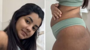 Ary Mirelle mostra mudanças do corpo após parto: 'Marcas do amor'