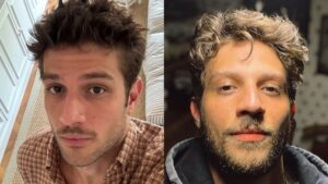Chay Suede desabafa após diagnóstico de dengue: 'Sufoco'