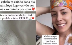 Fabiana Justus mostra o aumento da queda de cabelo: ‘Carequinha’