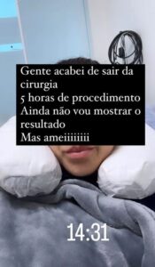 A influenciadora ficou 5 horas realizando o procedimento. Reprodução/Instagram - 19.03.2024