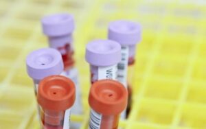 Consumidora recebe frasco com sangue pelo correio após compra na Shein