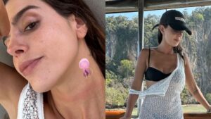 Giovanna Lancellotti é queimada por água-viva em viagem à Tailândia