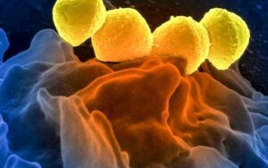 Japão vê aumento de casos de infecção por bactéria mortal