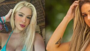 Karoline Lima mostra antes e depois dos procedimentos estéticos; veja