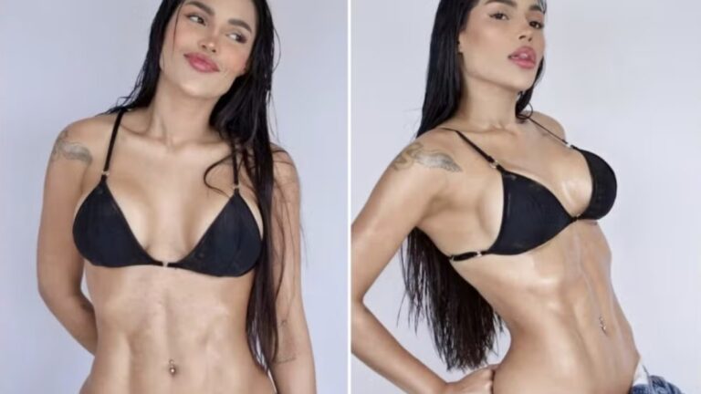 Ex-BBB Flay choca fãs ao exibir barriga sarada após lipo LAD perfeita