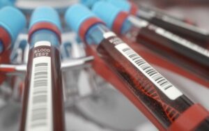 FDA recomenda exame de sangue para câncer colorretal