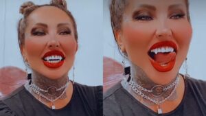 Após 6 litros de silicone, Sabrina Boing Boing coloca presas em dentes