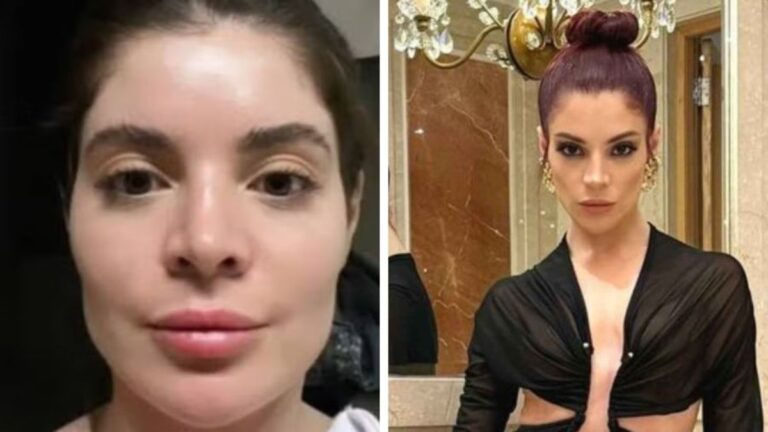 Gkay fala da retirada de procedimento estético: 'Beleza vem de dentro'