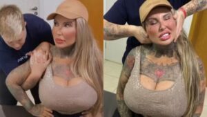 Sabrina Boing Boing trava coluna após próteses de silicone de 6 litros