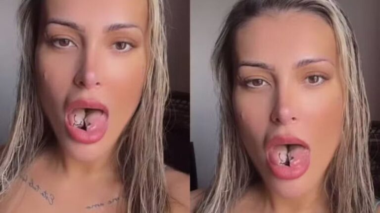 Andressa Urach mostra recuperação da língua bifurcada