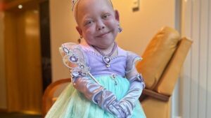 Morre a tiktoker Bella Brave, que tinha corpo de bebê por raríssima doença, aos 10 anos