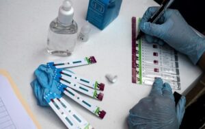 Testes rápidos de HIV