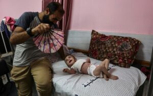 O bebê palestino Wateen al Adasi, que contraiu uma doença de pele devido à desnutrição, no hospital Kamal Adwan em Beit Lahia, norte da Faixa de Gaza, em 2 de julho de 2024