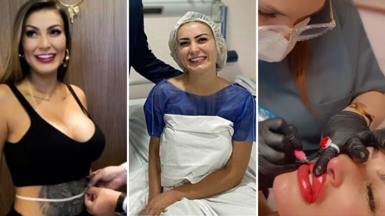 Recentemente, Andressa chamou a atenção ao revelar que vai retirar as costelas para afinar a cintura. Ela contou que pretende 'deixar o corpo mais bonito' para produzir vídeos de conteúdo adulto. A modelo também vai aproveitar a cirurgia para aumentar a prótese de silicone nos seios. 'Quero colocar o máximo de silicone que couber (...) Imagina que lindo, peito bem grande e cintura bem fina. Quero vender mais conteúdos', disse. Reprodução/Instagram - 14.03.2024