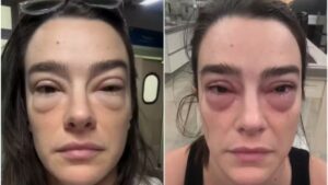 Mariana Molina vai ao hospital depois de ter reação a remédio