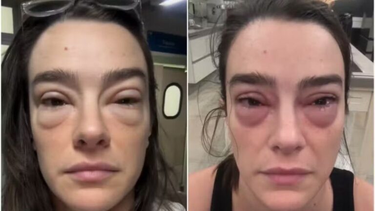 Mariana Molina vai ao hospital depois de ter reação a remédio