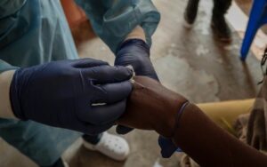 A República Democrática do Congo e outros países africanos que estão enfrentando surtos de mpox não têm vacinas suficientes, alertam agências humanitárias