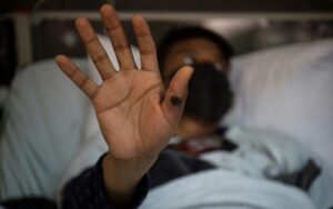 Paciente mostra a mão com lesão provocada pelo mpox em 16 de agosto de 2022 em Lima, Peru