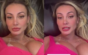 Andressa Urach gasta fortuna em procedimento inusitado no rosto: 'É a dor da beleza'