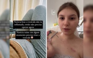 Lutando contra câncer, Isabel Veloso revela tamanho do tumor