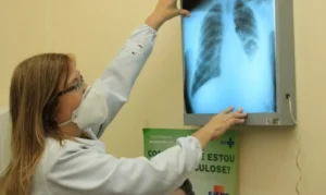 Dourados intensifica ações para o combate à Tuberculose