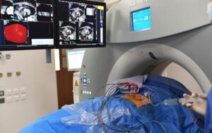 (Arquivo) Radiologista trata um tumor maligno de um paciente com tumor renal em 7 de novembro de 2017 em Marselha, França