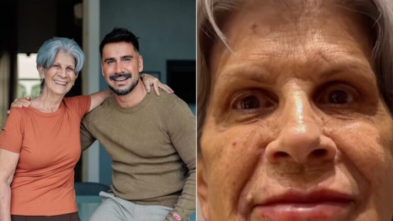 Aos 74 anos, mãe de Julio Rocha faz harmonização facial