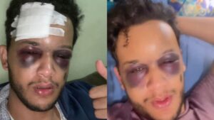 Cantor sofre traumatismo craniano após acidente em rodovia no MS