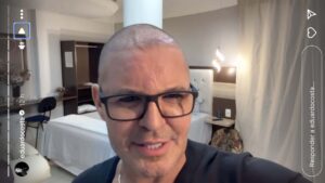Eduardo Costa explica queda de cabelo: " Usei muita bomba"