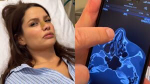 Juliette sofre acidente doméstico e fratura o nariz; vídeo