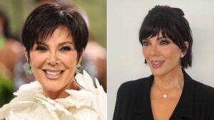Kris Jenner 20 anos mais jovem? Entenda a medicina regenerativa