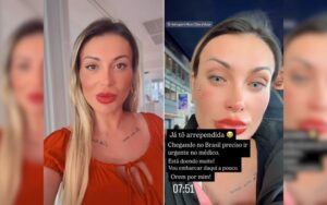 Andressa Urach relata dor intensa após mudar cor dos olhos