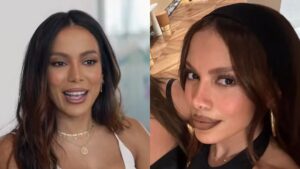Anitta surpreende fãs ao debutar "novo rosto" após infecção