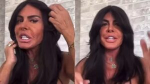 Gretchen mostra nova harmonização facial e exibe rosto sem filtro
