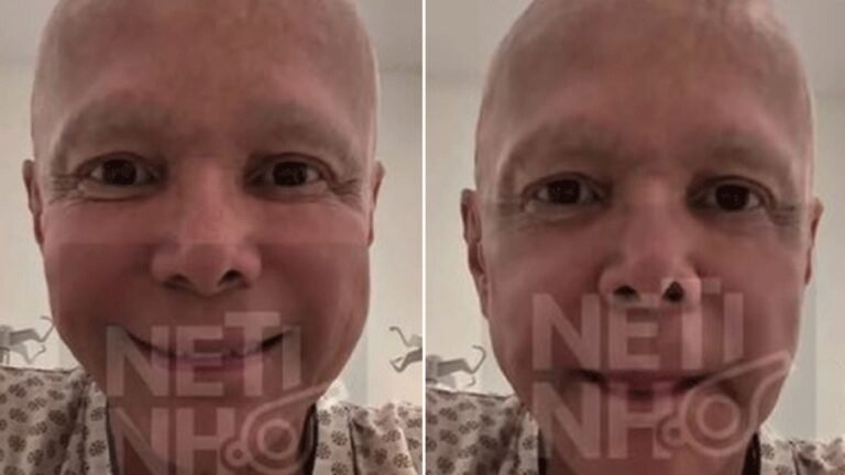 Netinho atualiza fãs sobre tratamento de câncer