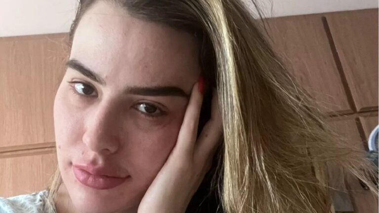 Ex-BBB Fernanda Keulla revela diagnóstico de doença rara