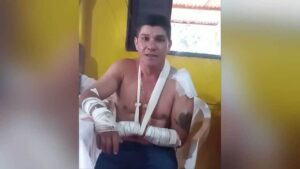 Rapaz que sobreviveu a ataque de onça conta experiência em Rio Verde