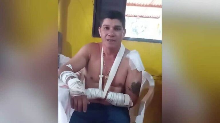 Rapaz que sobreviveu a ataque de onça conta experiência em Rio Verde