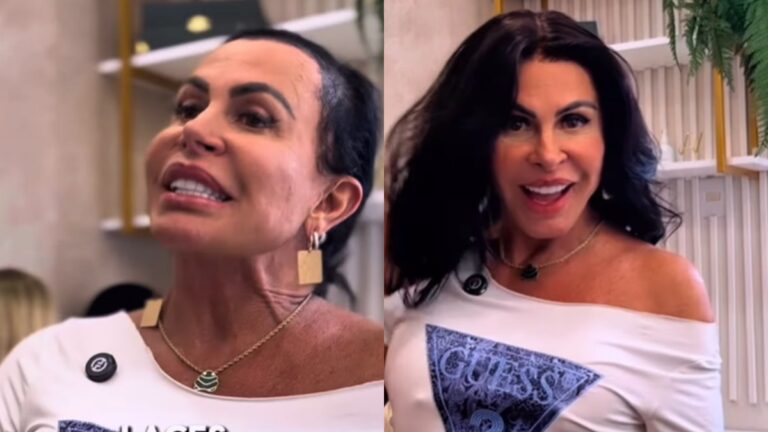 Diagnosticada com alopecia, Gretchen renova o visual